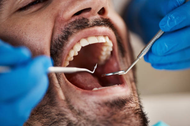 Best After-Hours Dental Trauma Care in Mount Gilead, NC