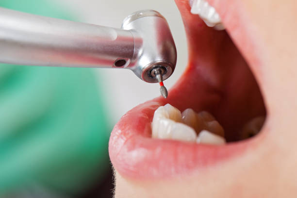 Best Same-Day Emergency Dental Services in Mount Gilead, NC